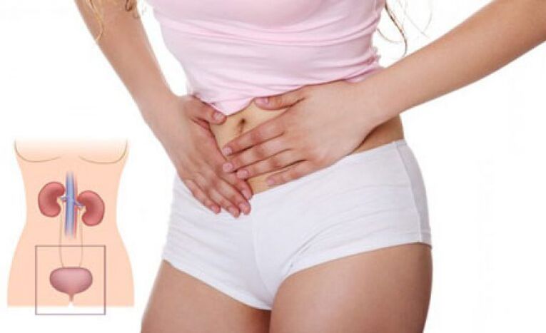 A cystitis egyik tünete a nőknél a szuprapubicus területen jelentkező fájdalom.