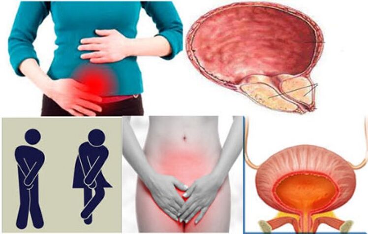 A cystitis jelei nőknél - égő érzés és fájdalom vizelés közben